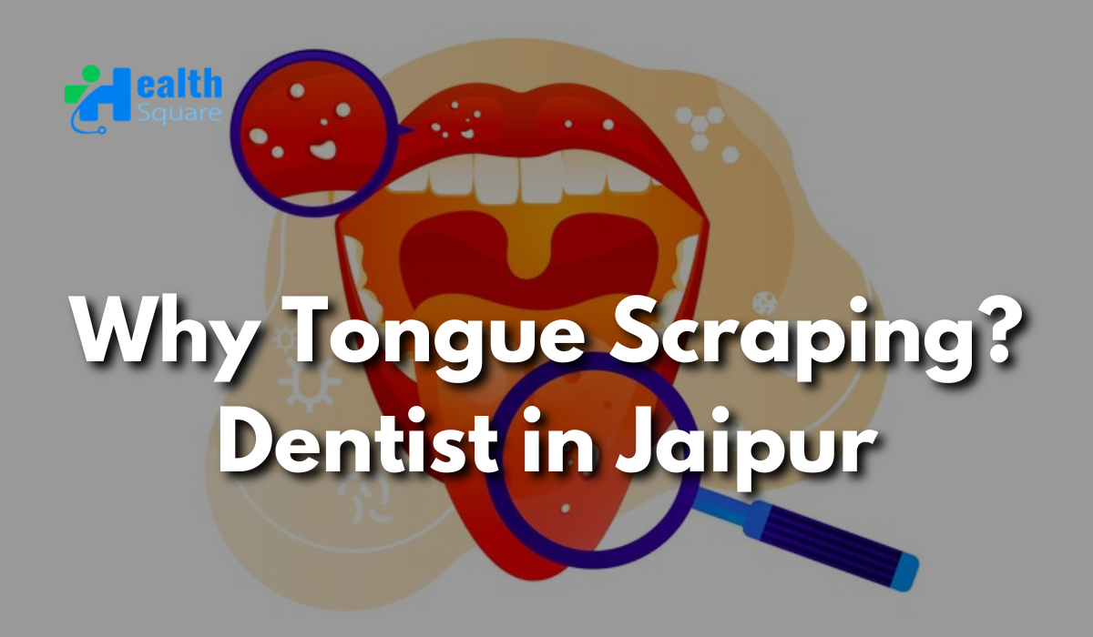Why Tongue Scraping? – Dentist in Jaipur